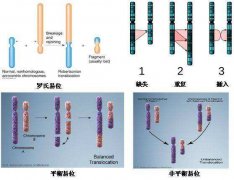 染色体易位，你找对原因了吗？